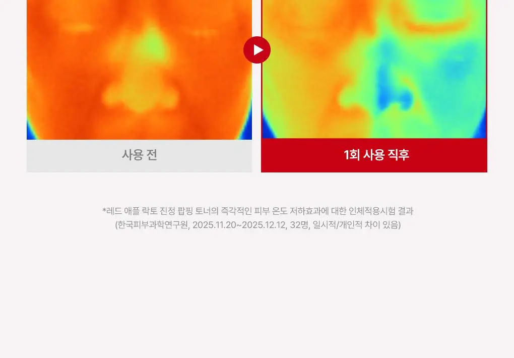 [NEW/단독기획] rdrd 레드 애플 락토 진정 팝핑 토너 95g 응급진정 KIT 기획 상세페이지 16